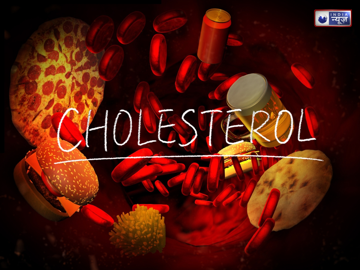 High Cholesterol - Photo Gallery