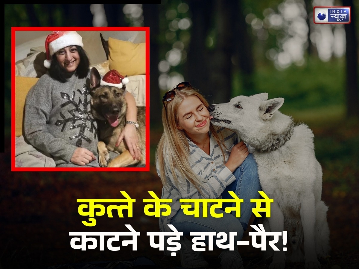 कुत्ते का चाटना पड़ गया भारी! महिला ने मौत को 6 बार दी मात, लेकिन गंवाए दोनों हाथ-पैर, दिल दहला देगी कहानी
