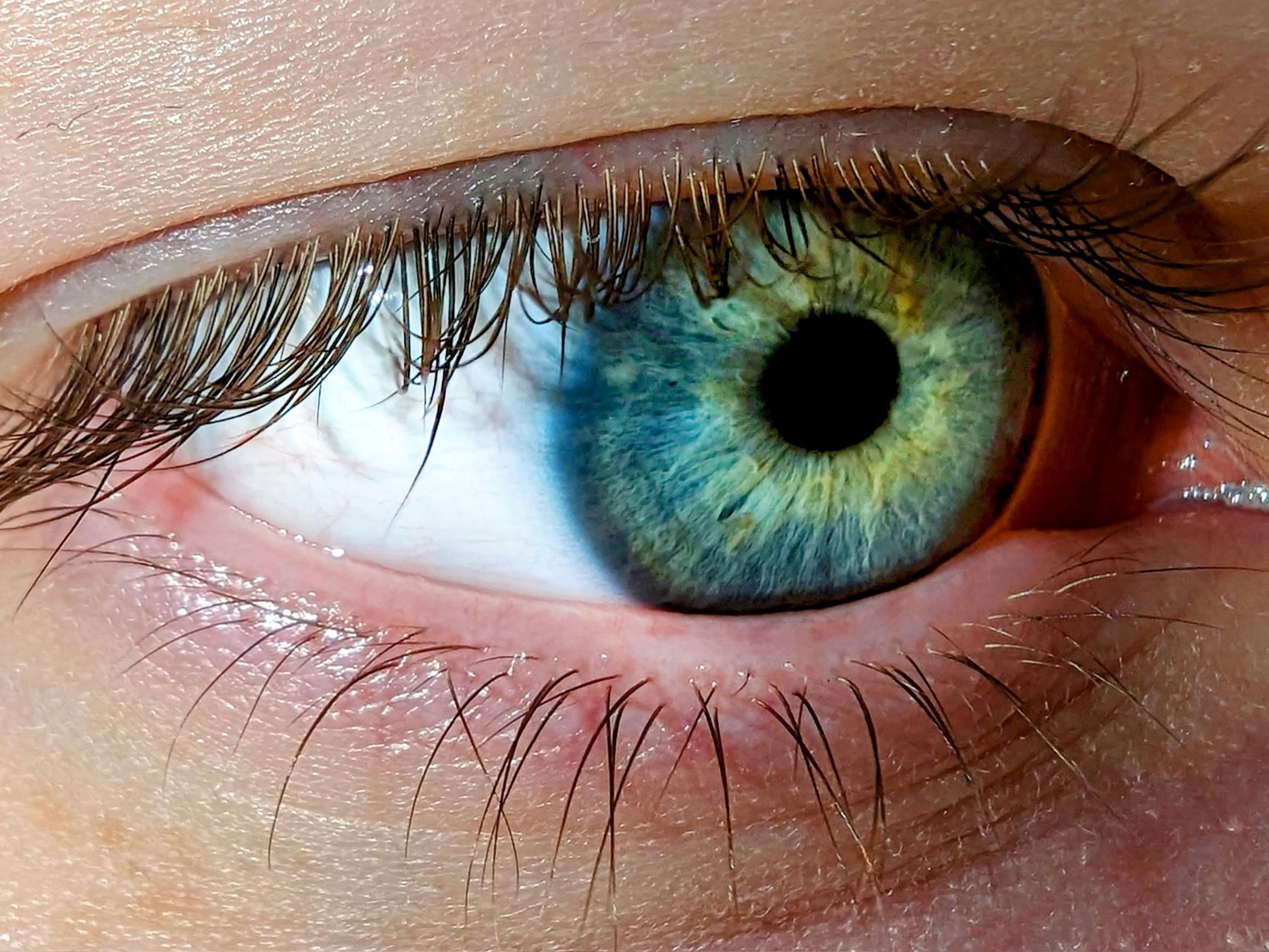 eye care tips - Photo Gallery