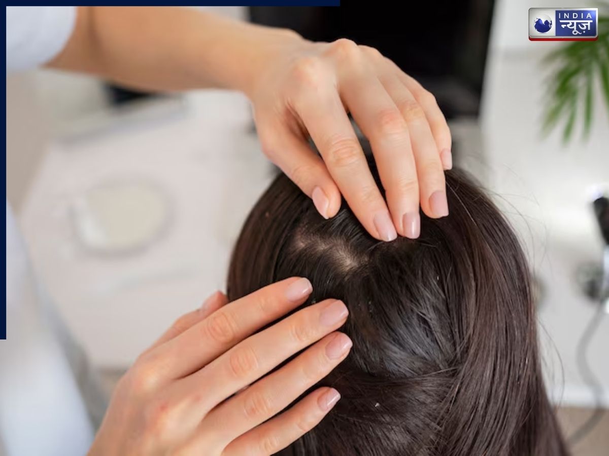 How to apply coconut oil to your hair? - Photo Gallery