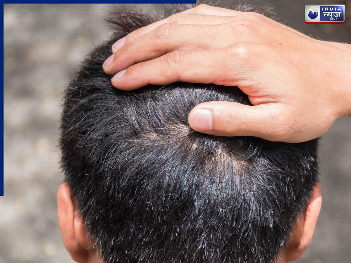 Hair roots become weak - Photo Gallery