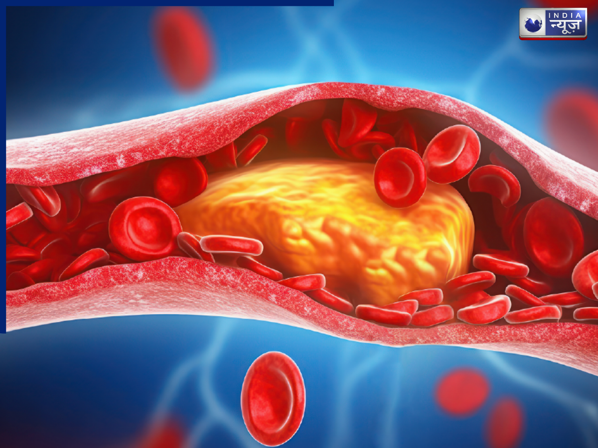 Lipoproteins cannot be changed - Photo Gallery
