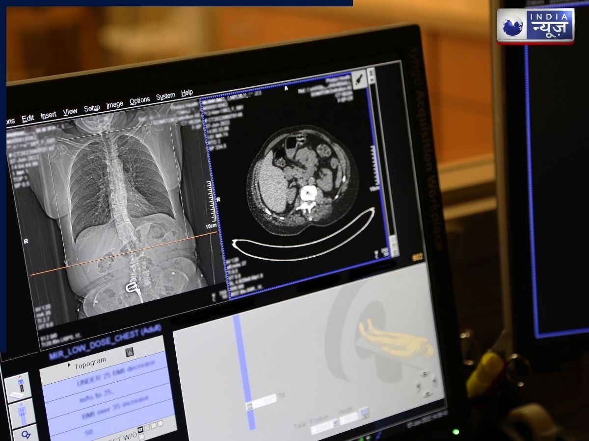 Tumor detection using technology - Photo Gallery