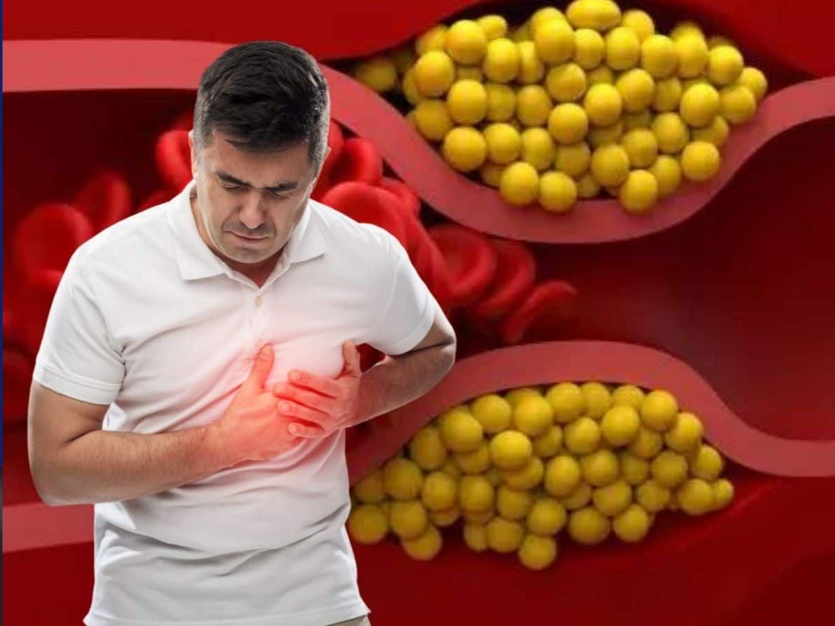 Manage Cholesterol - Photo Gallery