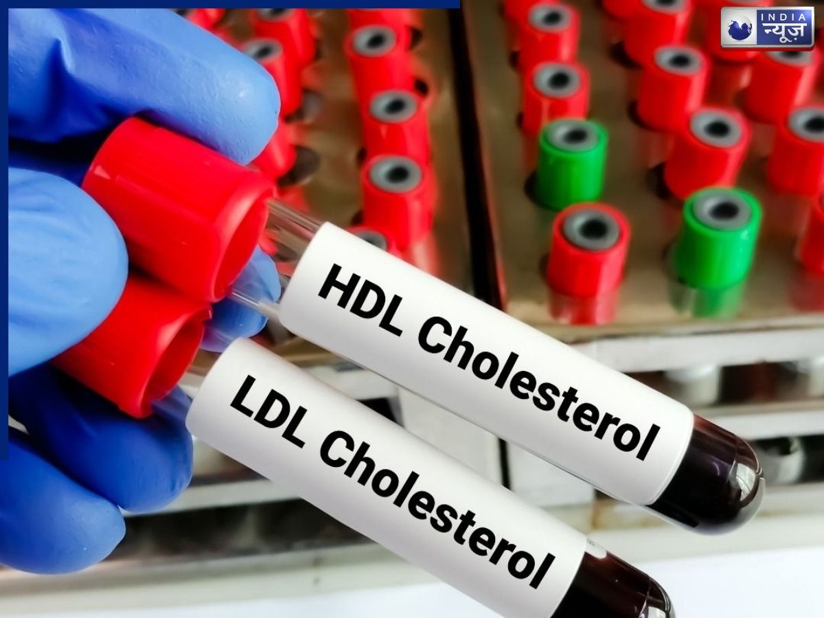 क्या खराब कोलेस्ट्रॉल कंट्रोल करने में मदद करती है मूंग दाल? जानिए डाइट में शामिल करने के फायदे और नुकसान