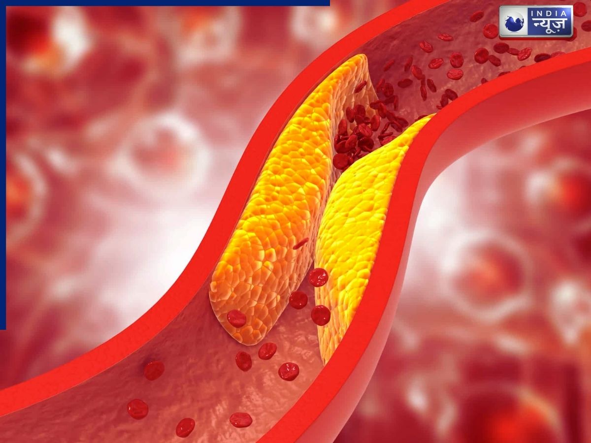 What are triglycerides - Photo Gallery