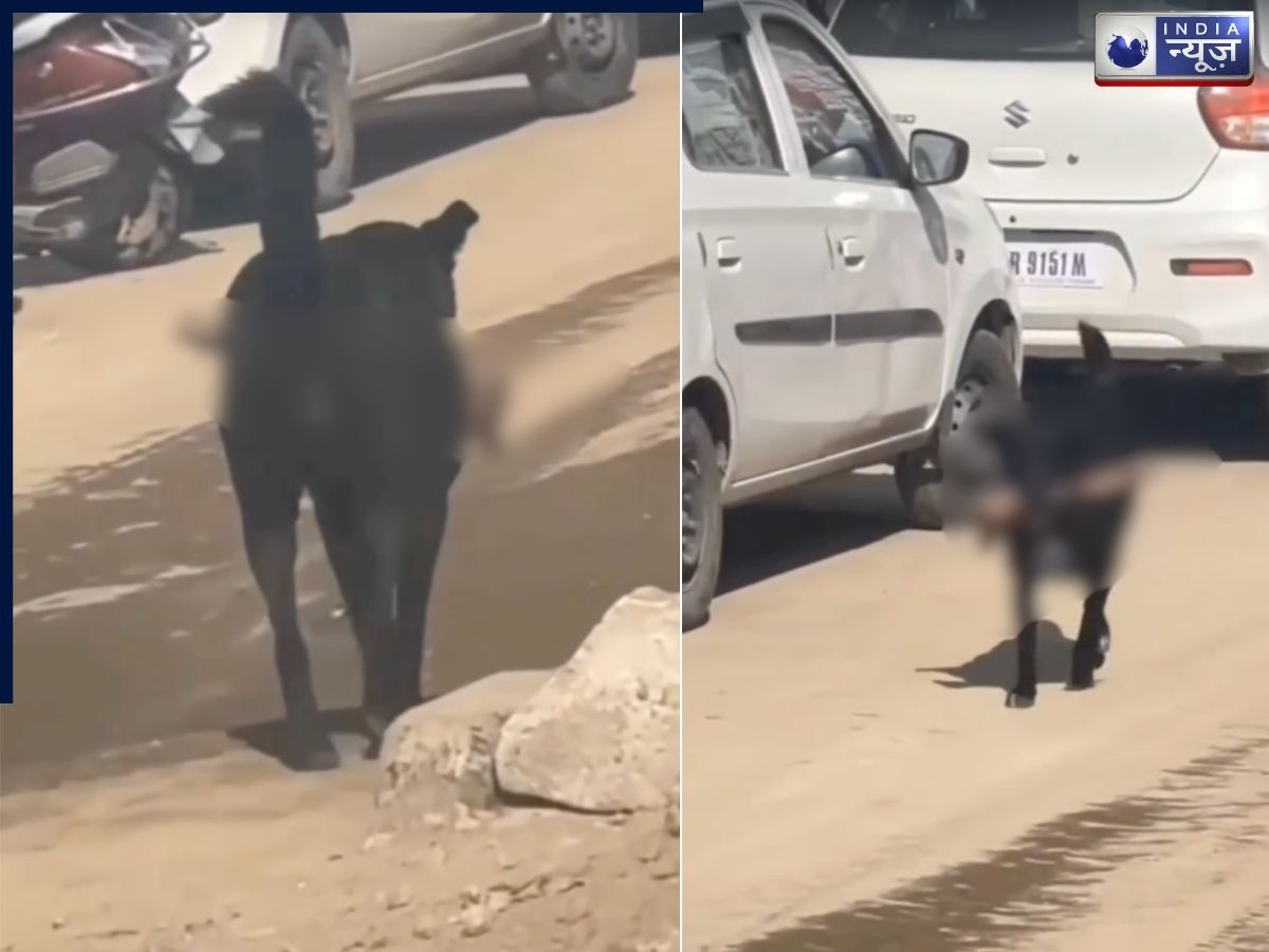 कुत्ते के मुंह में इंसान का कटा हुआ पैर, अस्पताल के बाहर देखकर हैरत में पड़ गए लोग; जानें- क्या है पूरा मामला?