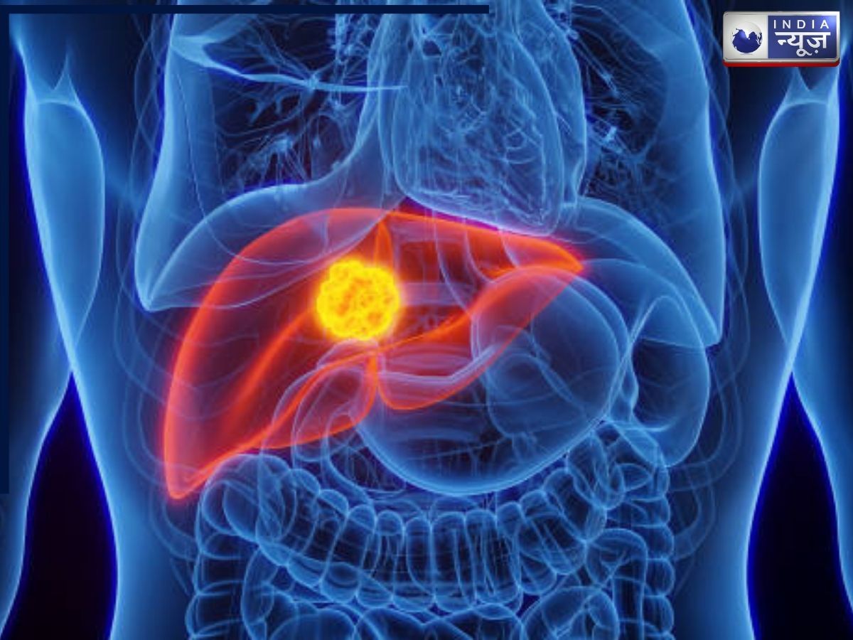लिवर कैंसर का कब पता चलता है, जिससे रिंकू सिंह के पिता की मौत हुई, क्या है इसके लक्षण, इलाज और जोखिम कारक