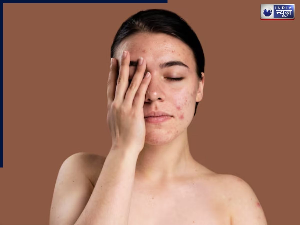 Regular facials are necessary for skin prone to acne and clogged pores - Photo Gallery