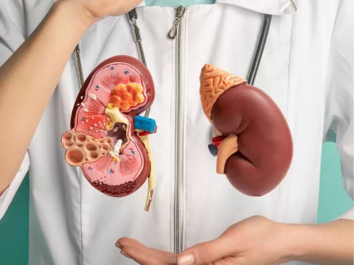 Support Kidney Health - Photo Gallery