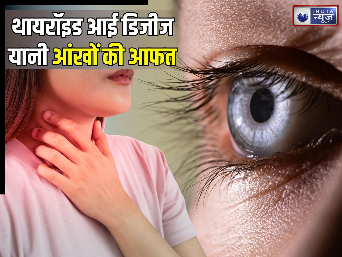 Thyroid Eye Disease: लाल आंखें, सूजन और दर्द भी… कहीं थायरॉइड आई डिजीज तो नहीं? जानिए इसके लक्षण, कारण और इलाज