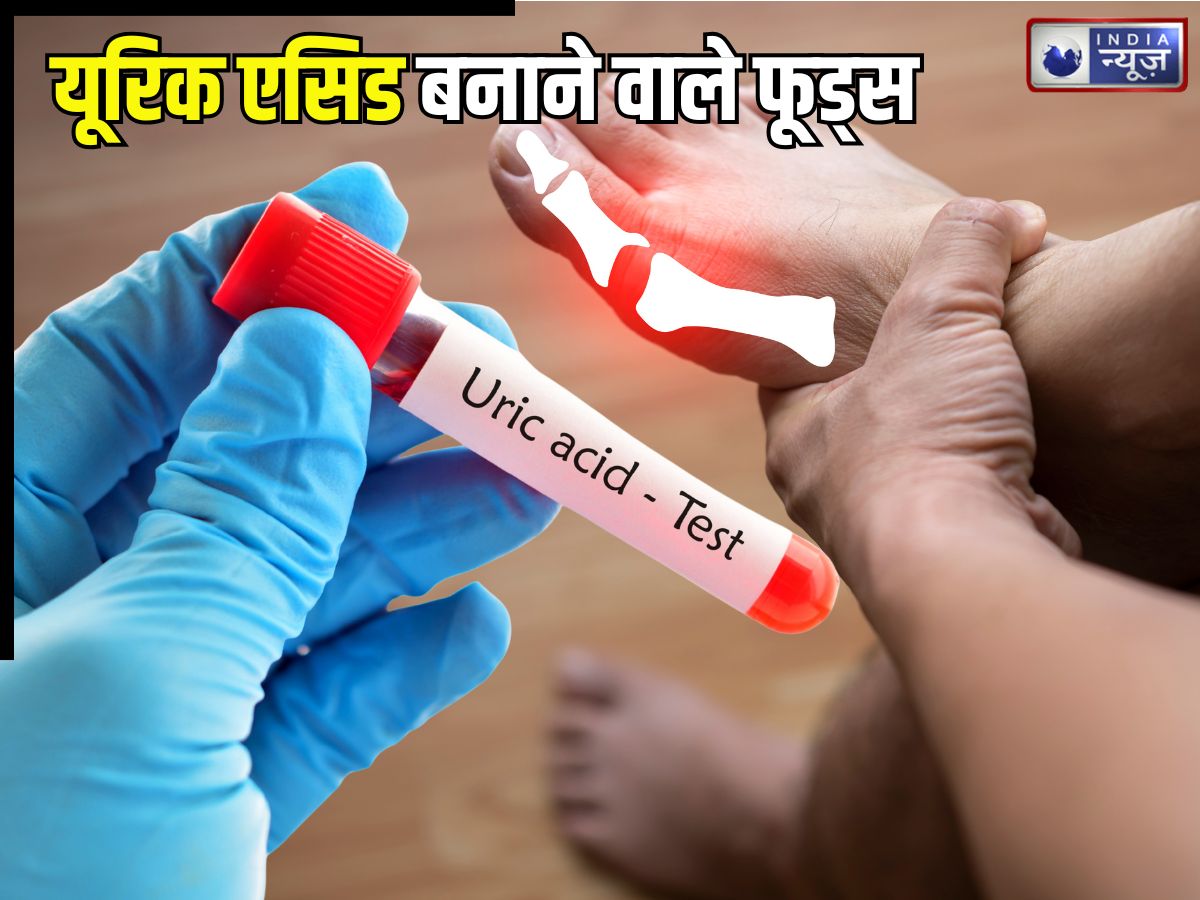 यूरिक एसिड का पारा हाई कर देंगी ये 5 चीजें! किडनी का भी कर देतीं बुरा हाल, एक्सपर्ट से जानें क्या खाना फायदेमंद