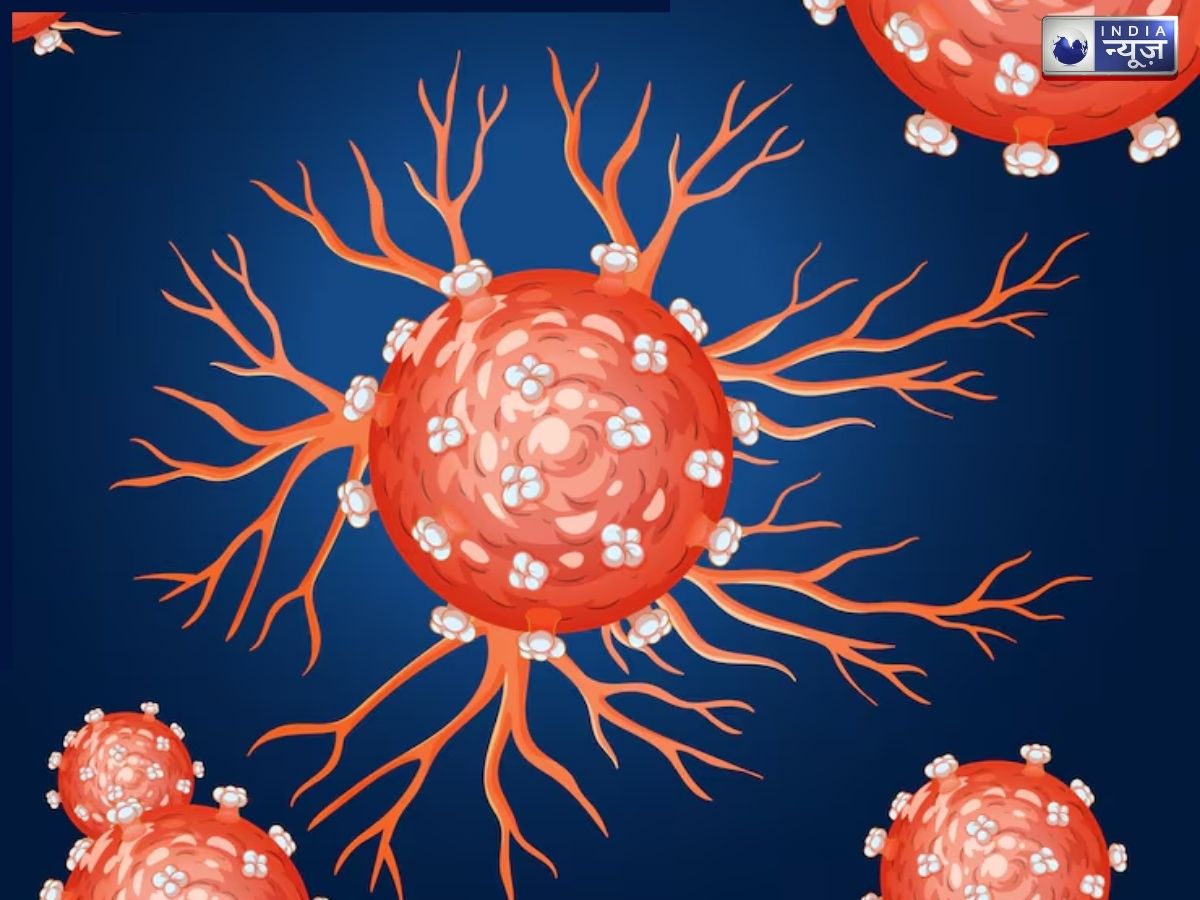 Common types of cancer - Photo Gallery