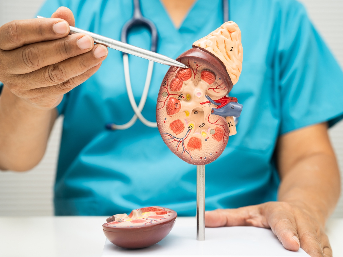 When does a kidney stone pass? - Photo Gallery