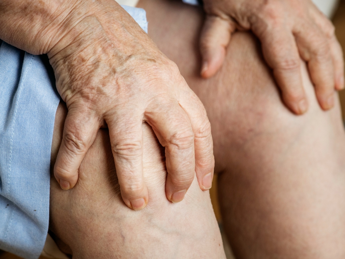 Calcium deficiency - Photo Gallery