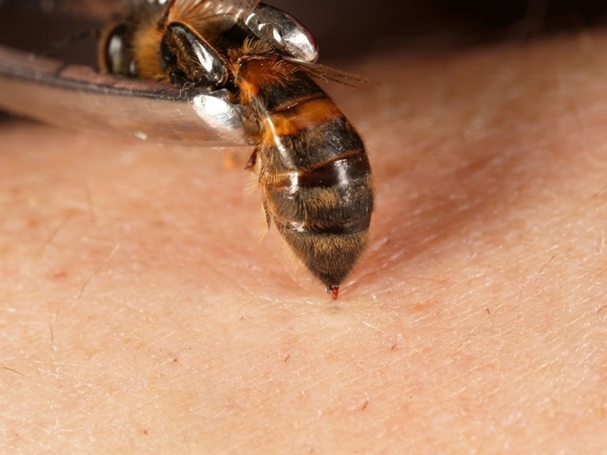 Why do bees attack humans, how to prevent it - Photo Gallery