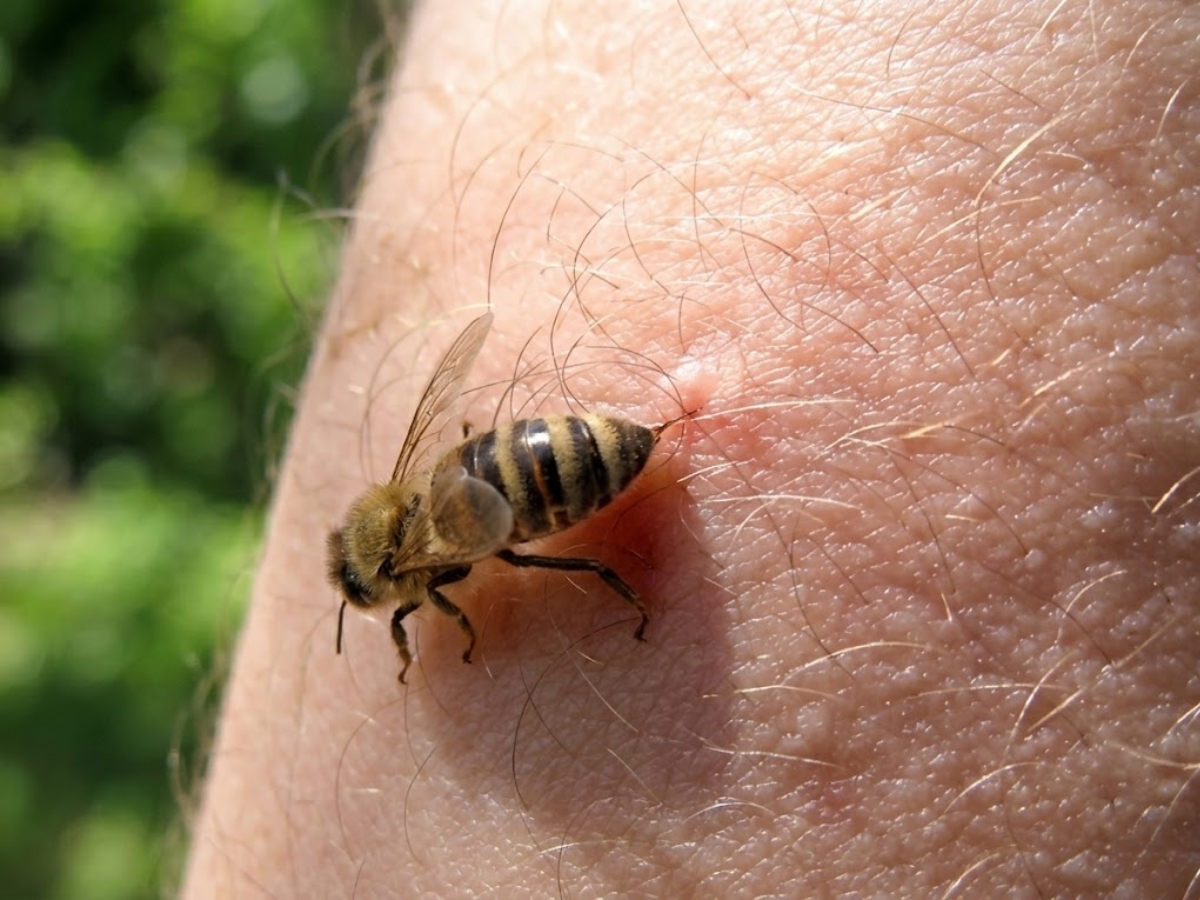 Why do bees attack humans, how to prevent it - Photo Gallery