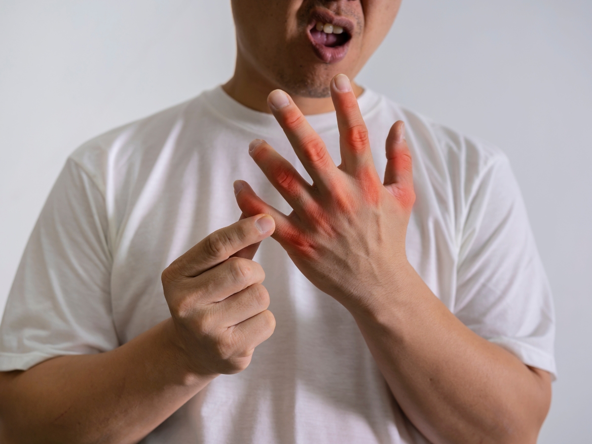 Why is uric acid level increasing? - Photo Gallery