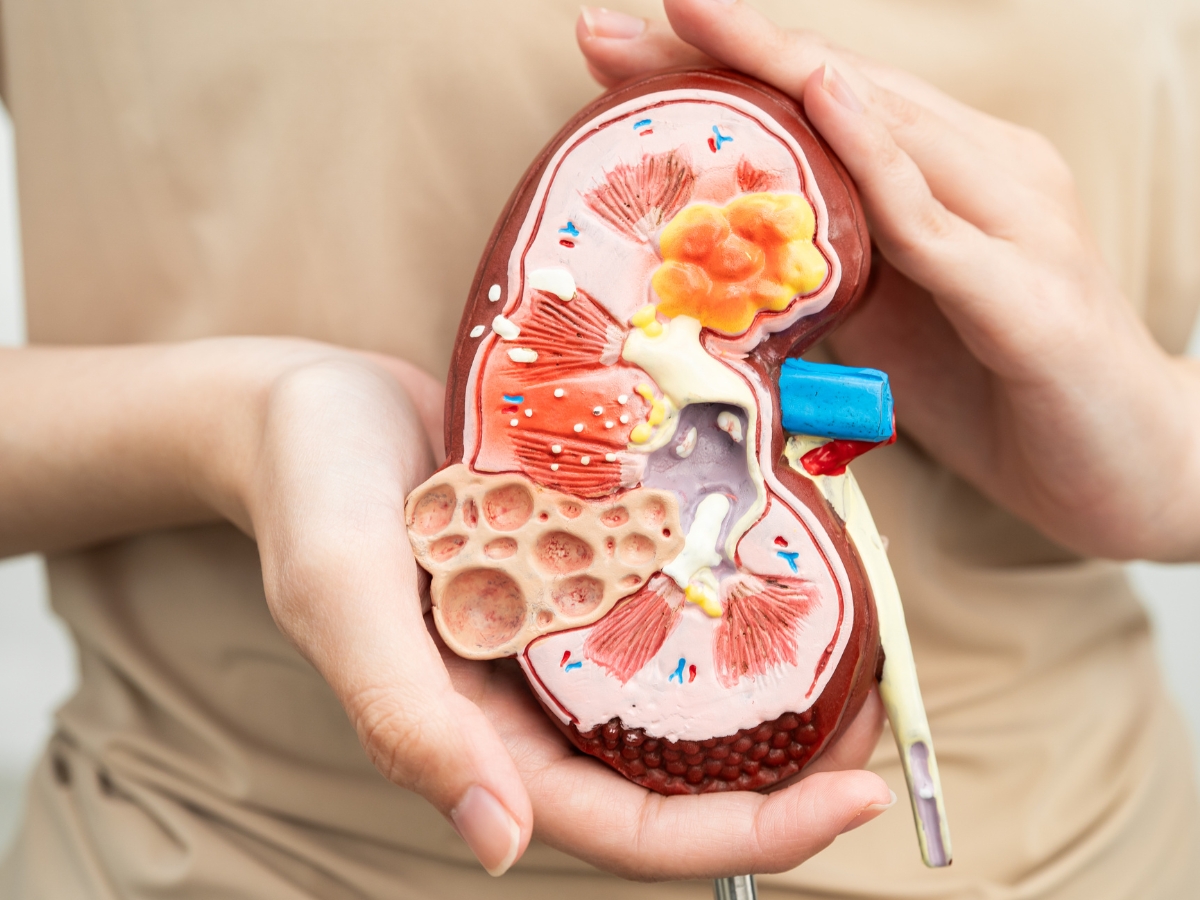 Consuming excessive salt - Photo Gallery