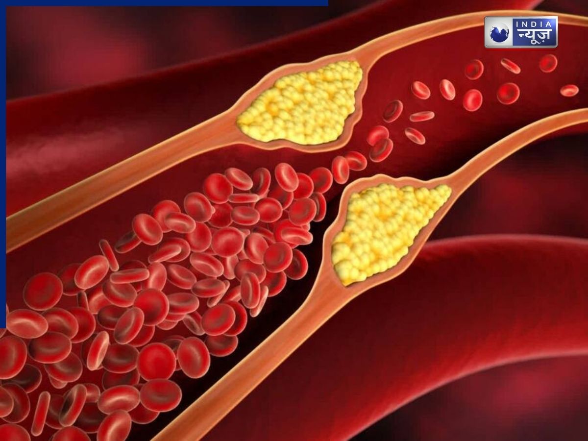 Cholesterol: क्या गर्म पानी पीने से पिघलता है कोलेस्ट्रॉल? वायरल दावा कितना सही, क्या कहती है साइंस