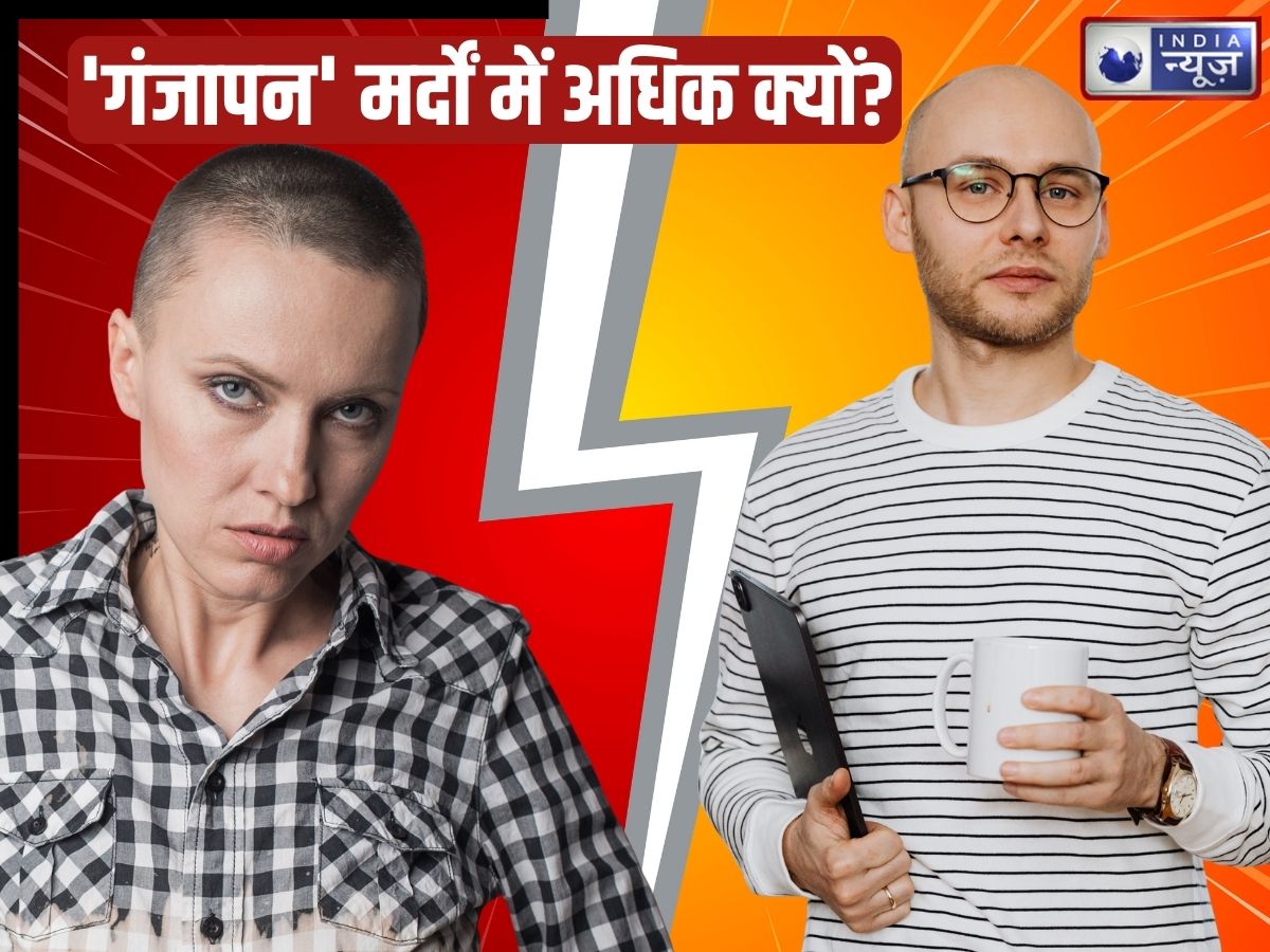 Male vs Female Baldness: मर्द ही ‘गंजेपन’ का शिकार क्यों, महिलाएं क्यों नहीं? जानिए इसके पीछे का विज्ञान
