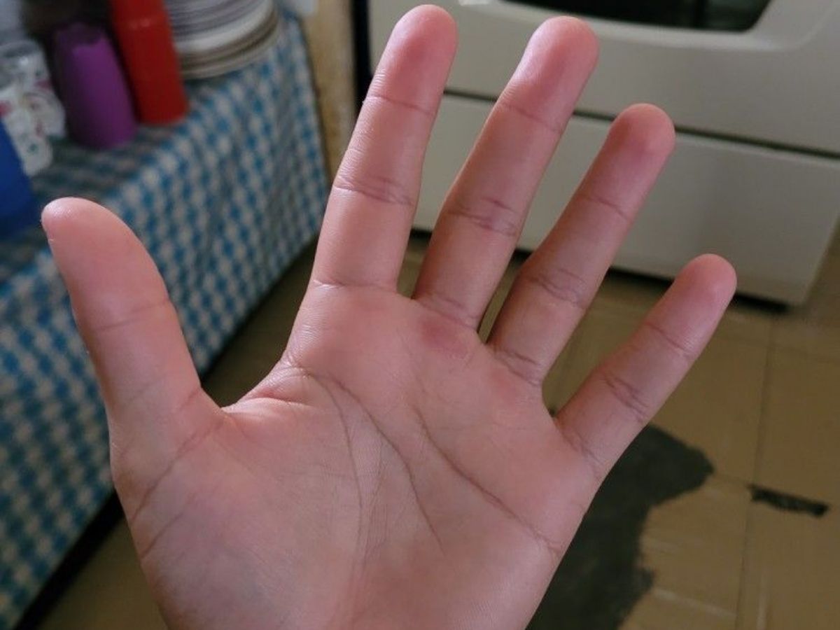 Cross Mark on Head Line Palmistry Meaning - Photo Gallery