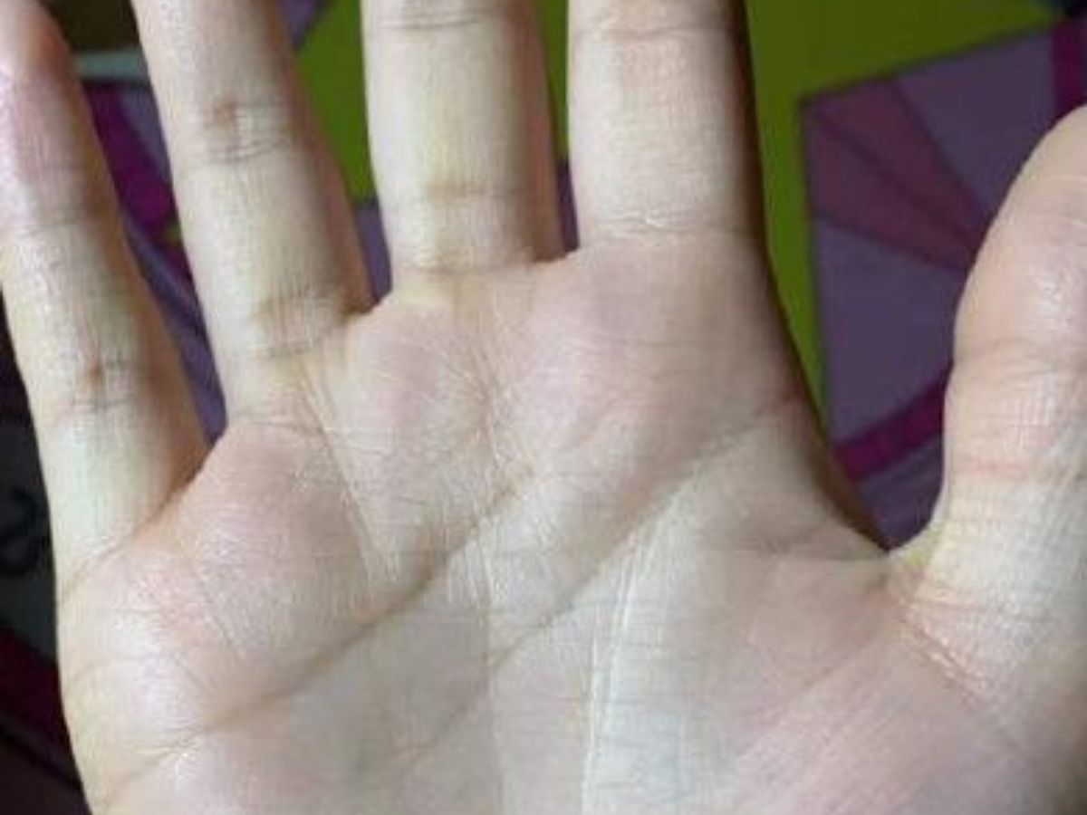 Cross Mark on Life Line Meaning and Impact - Photo Gallery