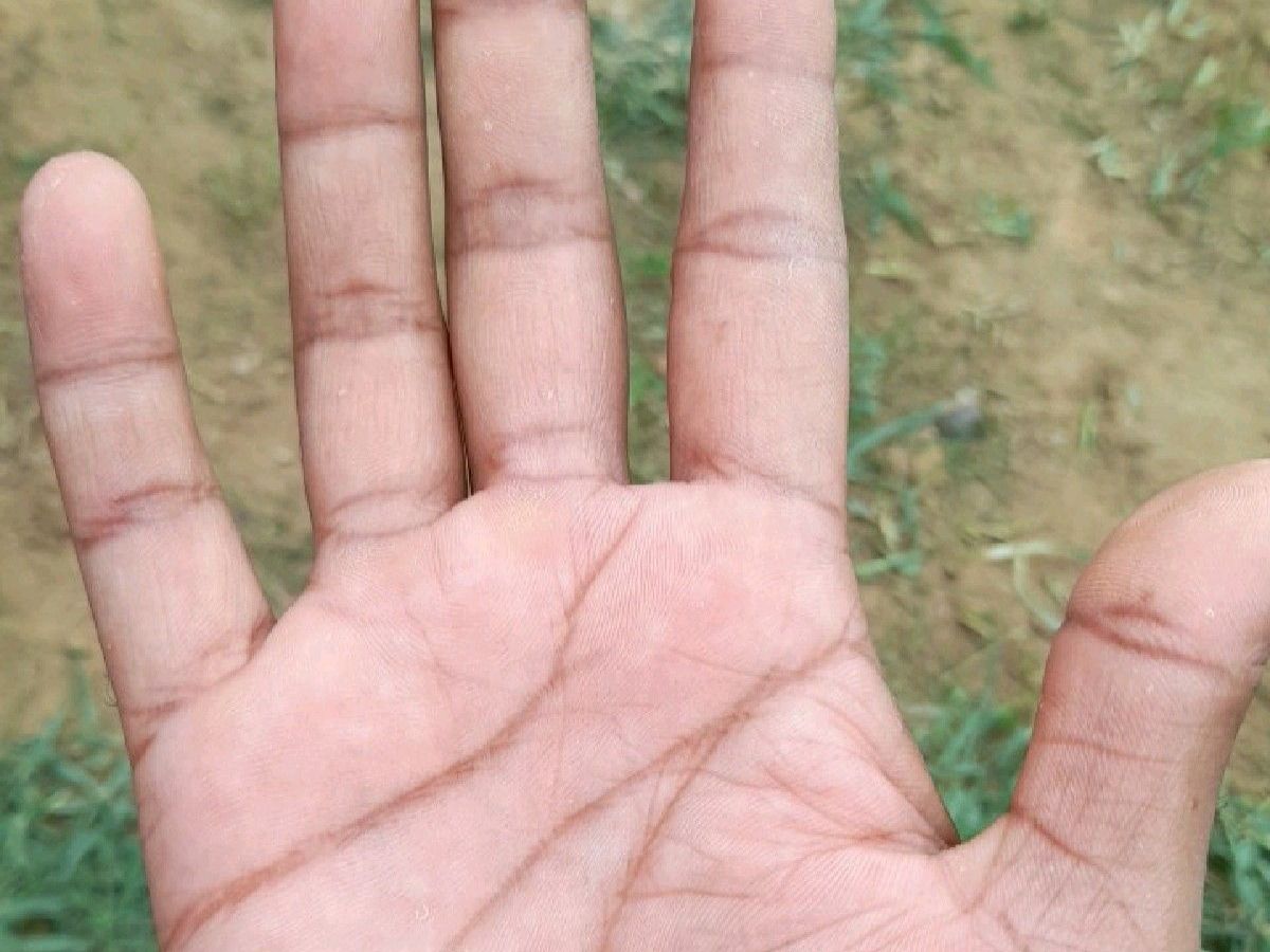 Cross Mark on Wrist Line Meaning in Palmistry - Photo Gallery