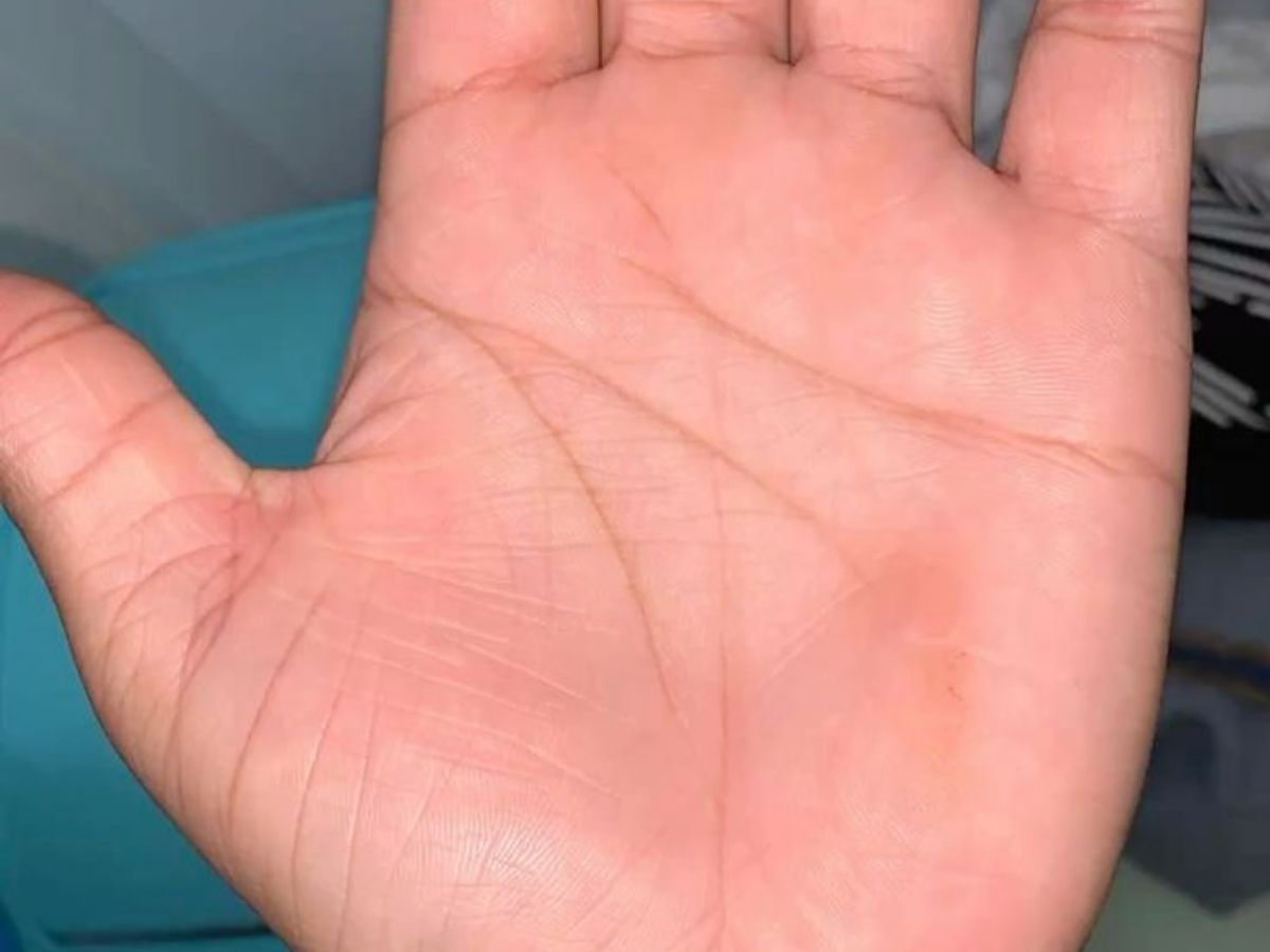 Cross Sign on Saturn Mount Effects and Remedies - Photo Gallery