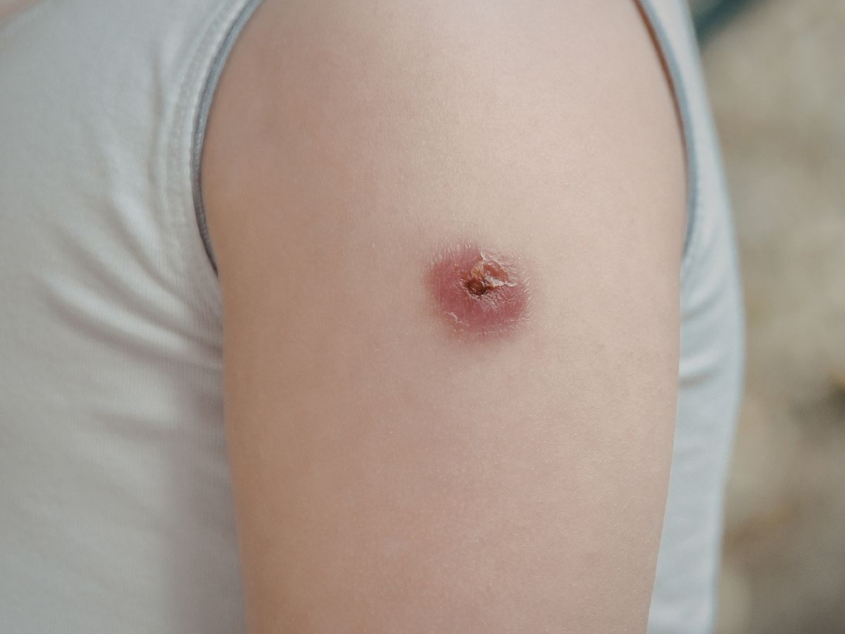 useful for healing wounds - Photo Gallery