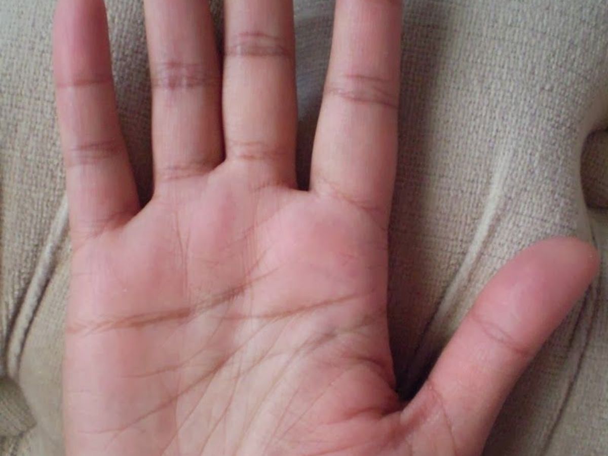 Is Every Cross Mark in Palm Bad or Good - Photo Gallery