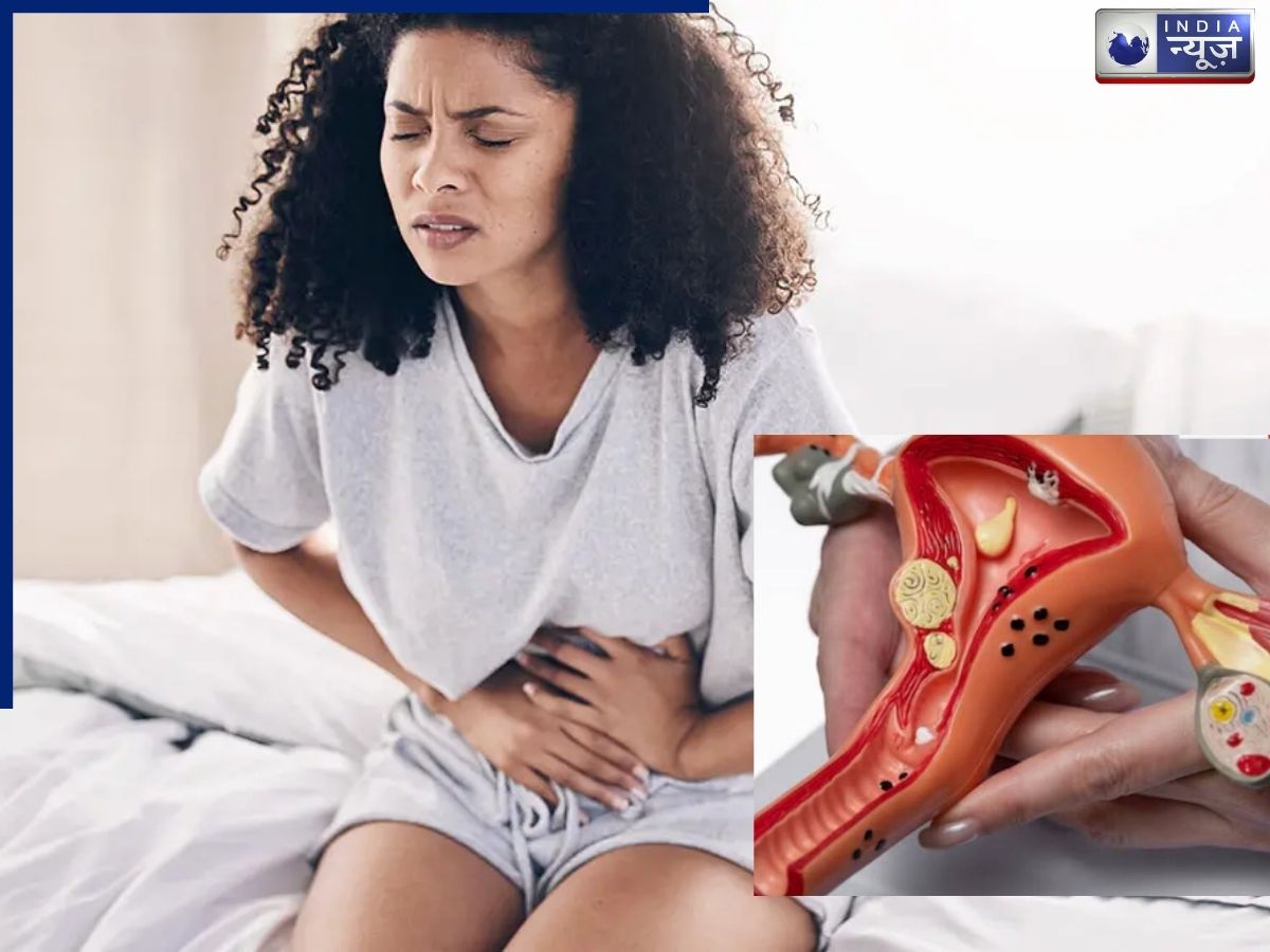 महिलाओं में एंडोमेट्रियोसिस क्यों होता है? तेजी से क्यों बढ़ रही यह समस्या, एक्सपर्ट ने बताए कारण और इलाज