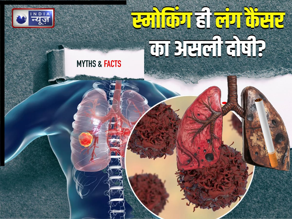 Lung cancer Myth: सिर्फ स्मोकिंग ही है लंग कैंसर का दोषी? क्या 65 से कम उम्र में भी बीमारी का खतरा
