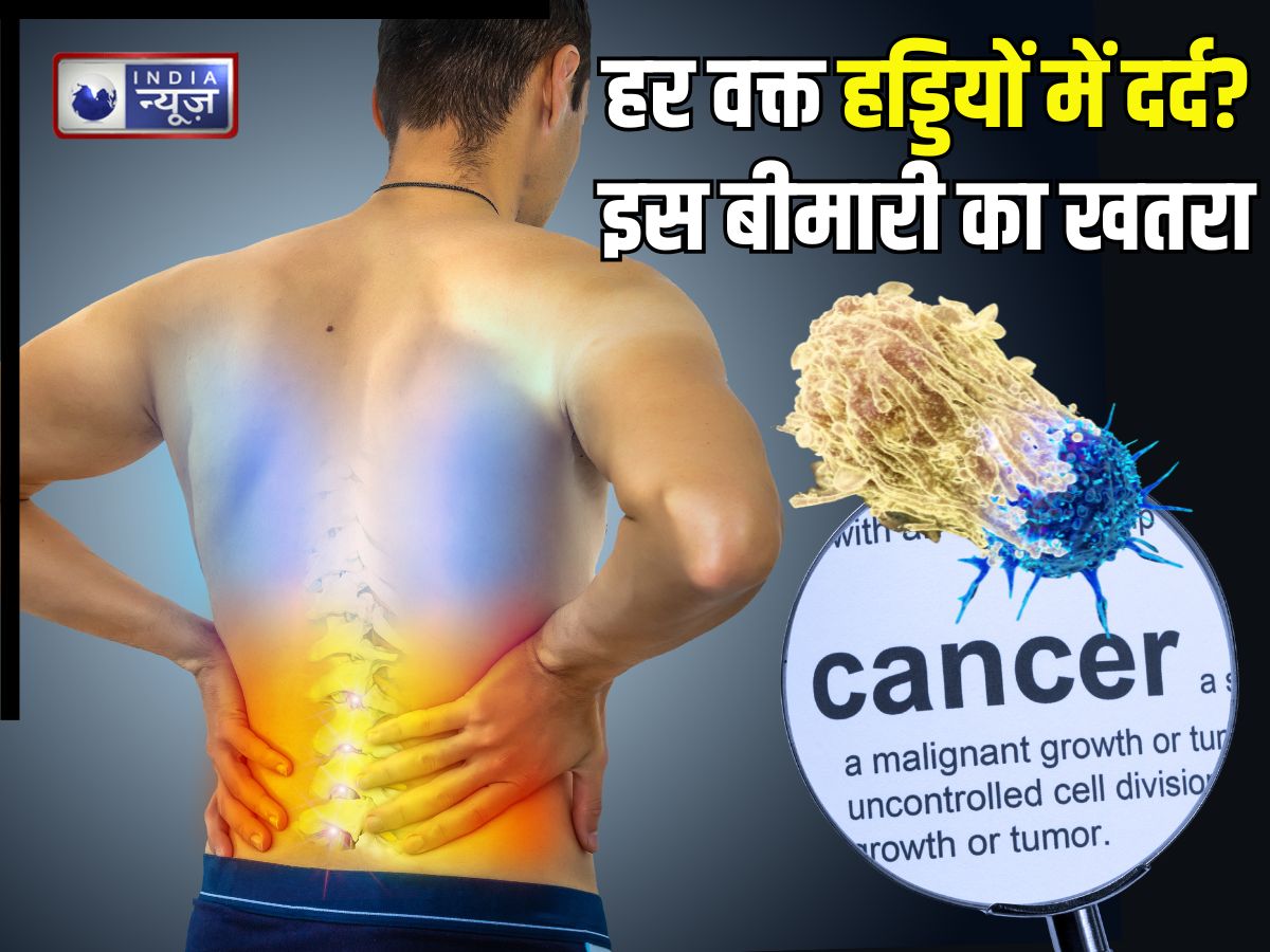 Multiple Myeloma: हर वक्त हड्डियों में दर्द… कहीं इस गंभीर बीमारी का संकेत तो नहीं? जानिए कारण, जोखिम और इलाज