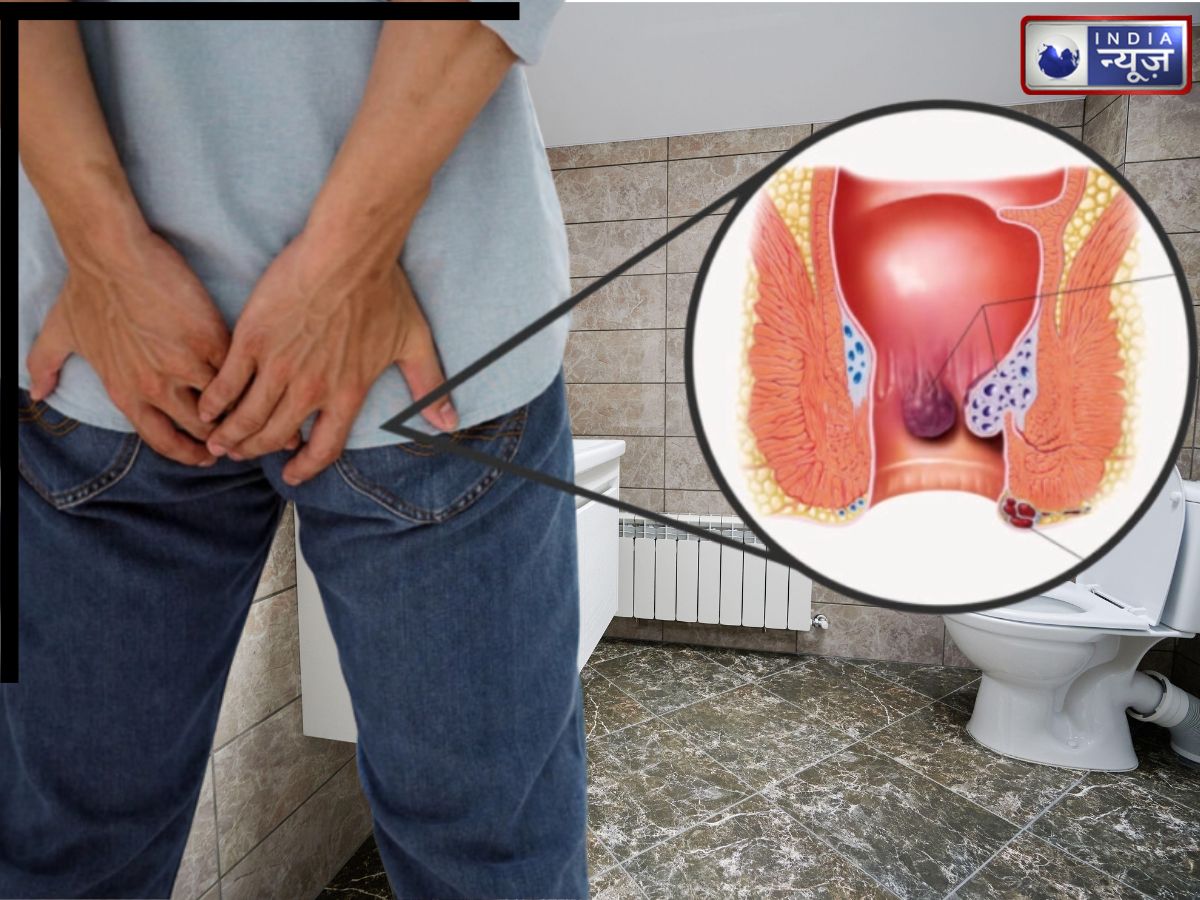 Piles Cure: बवासीर में औषधि का काम करती हैं ये 6 चीजें? 30 दिन सेवन करके तो देखिए, होंगे चौंकाने वाले फायदे