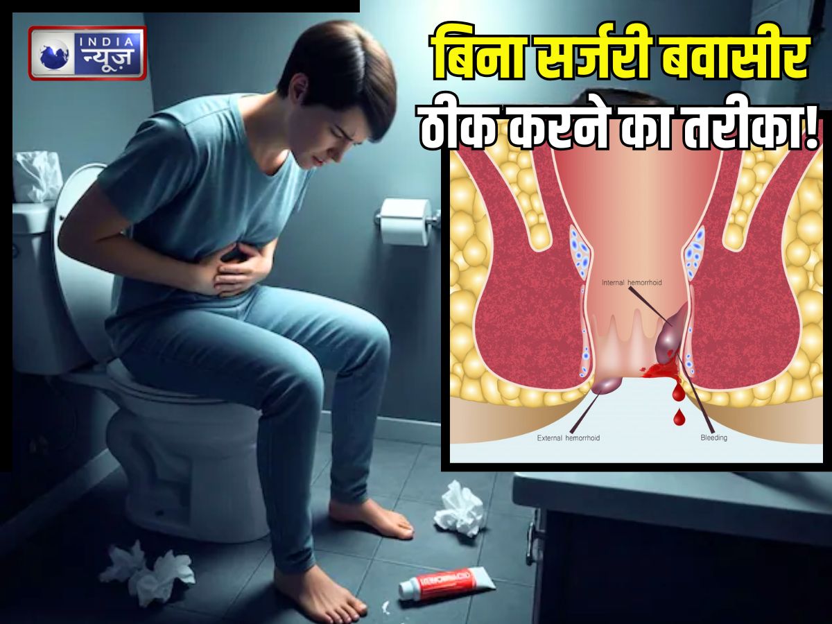 Piles Cure: बिना ऑपरेशन बवासीर हो जाएगी ठीक..! अगर फॉलो करेंगे ये 5 आयुर्वेदिक उपाय, दवाओं से भी मिलेगी मुक्ति