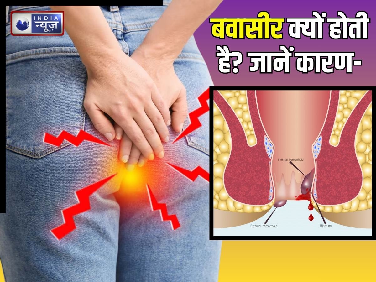 Piles Tips: बवासीर क्यों होती है? किन लोगों में इस बीमारी का खतरा अधिक, नोट करें इसके लक्षण और बचाव टिप्स