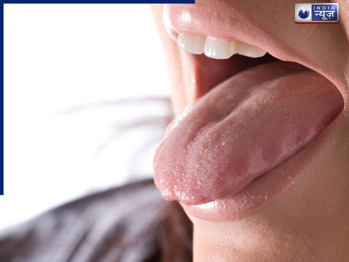 लाल, सफेद या पीली? जीभ का रंग बदलना, शरीर में किस बीमारी का संकेत है, डॉक्टरों ने बताई सच्चाई