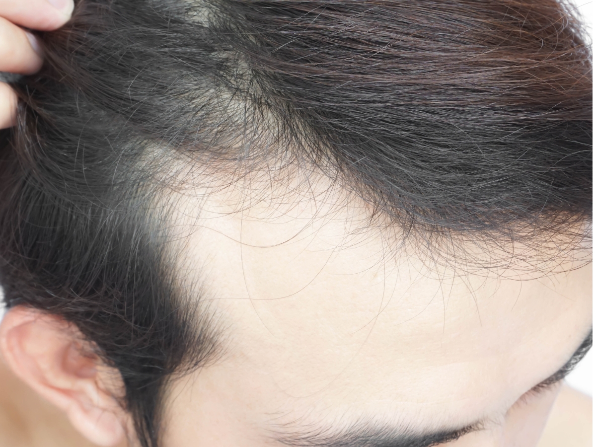 Vitamin Sources - Photo Gallery