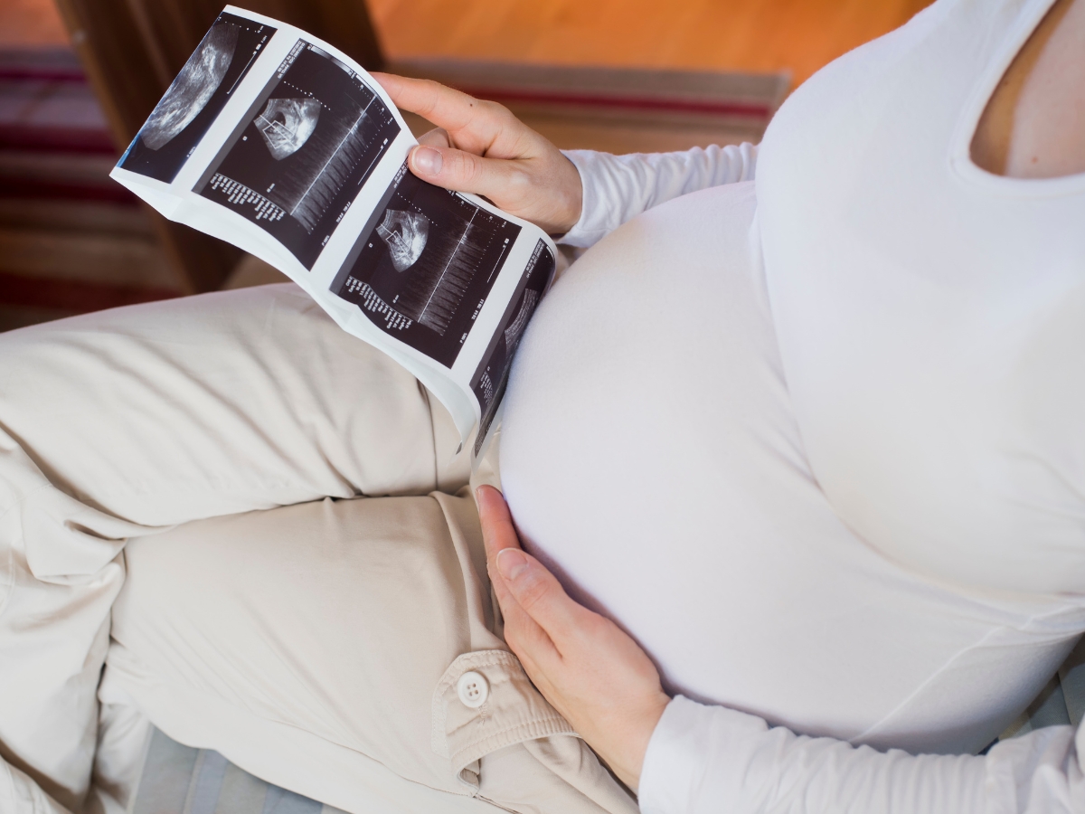 Acid Reflux - Photo Gallery