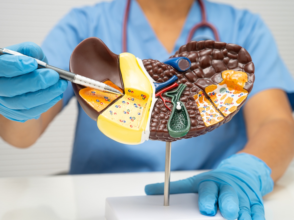 Fatty Liver Grade 1 - Photo Gallery