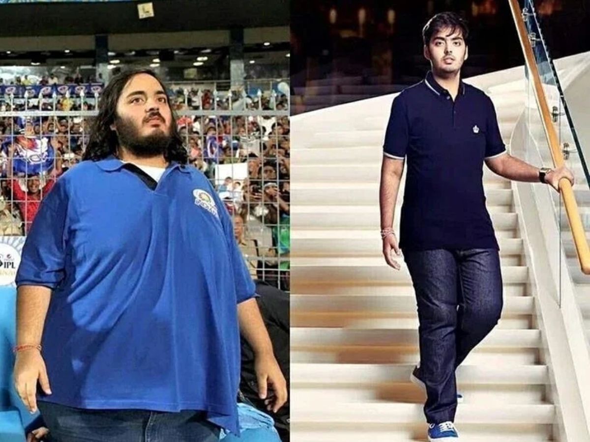 Anant Ambani disease - Photo Gallery