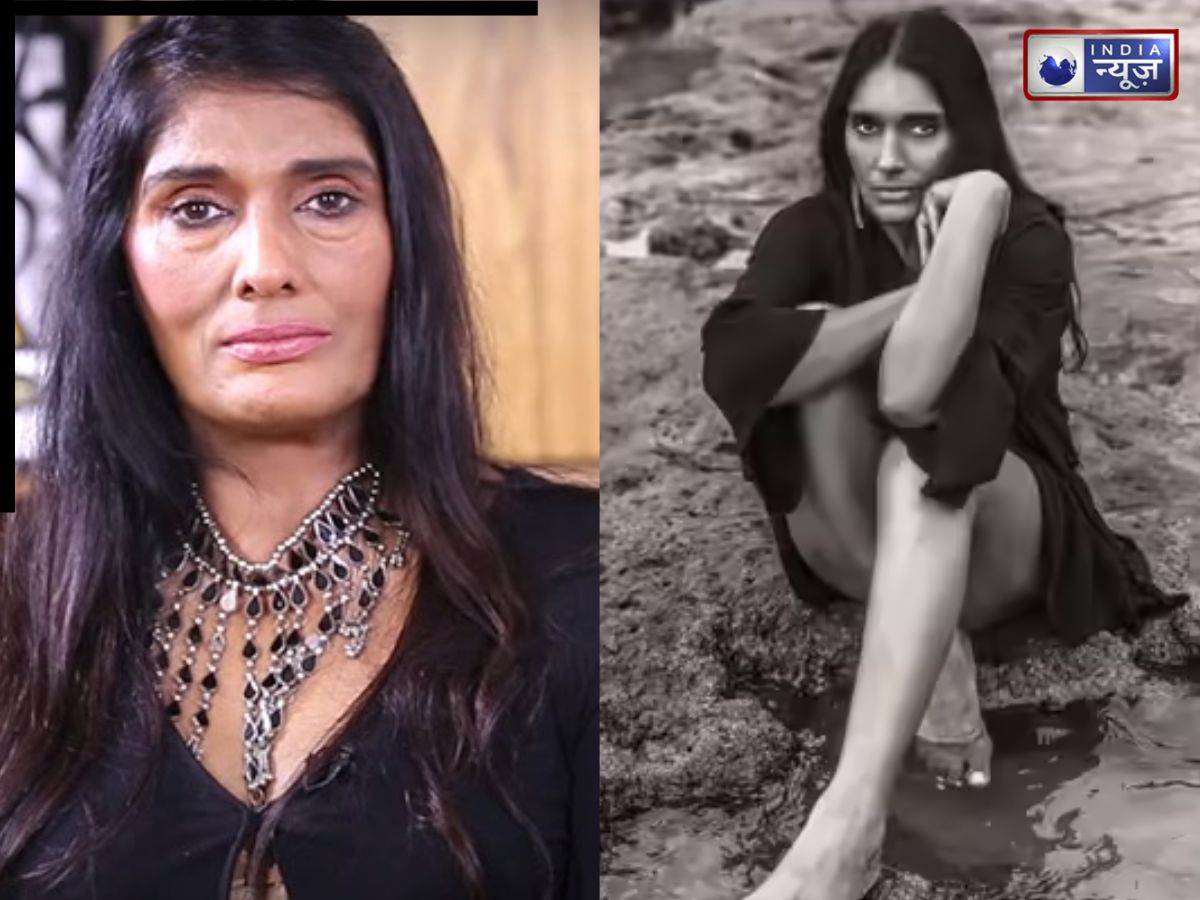 रातों-रात स्टार बनीं ये एक्ट्रेस, एक दर्दनाक एक्सीडेंट ने बदल दी जिंदगी, हुआ पुनर्जन्म; देखते ही डर गए लोग