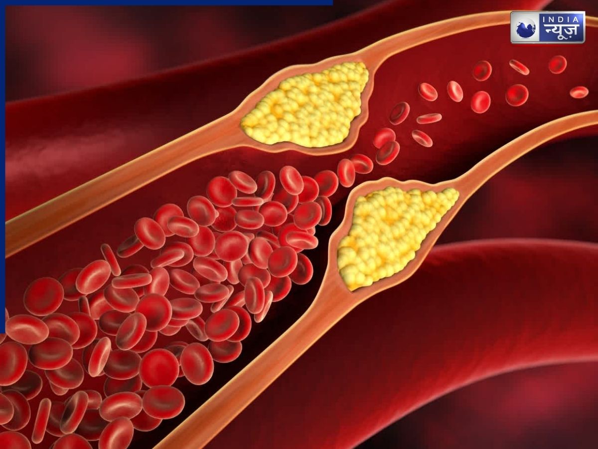 Cholesterol Levels: कोलेस्ट्रॉल को लेकर बदले नियम, कितना होना चाहिए नॉर्मल लेवल, किस उम्र में जरूरी है टेस्ट? - Photo Gallery