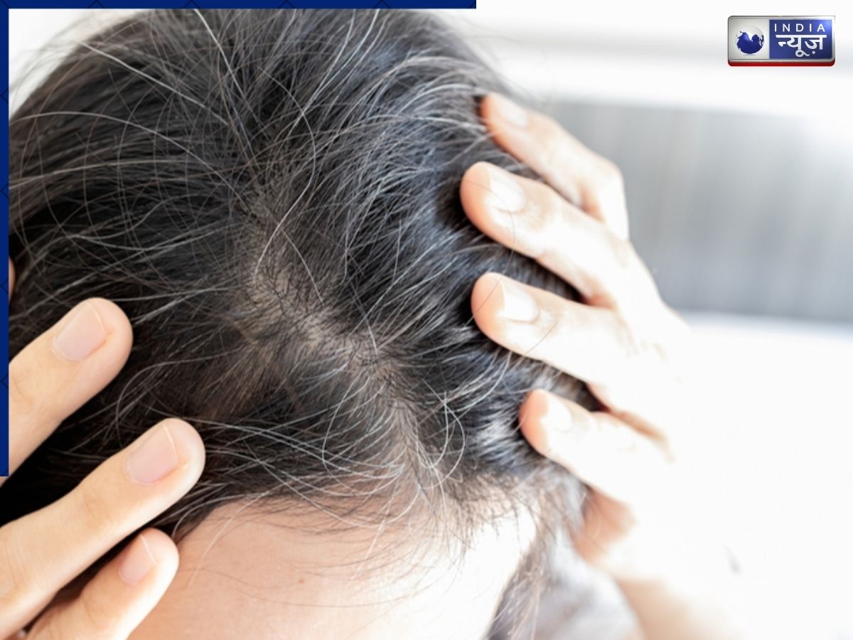 Hair Problems: जल्दी सफेद हो रहे बाल? कारण जानकर रह जाएंगे हैरान, अपनाएं ये आसान उपाय