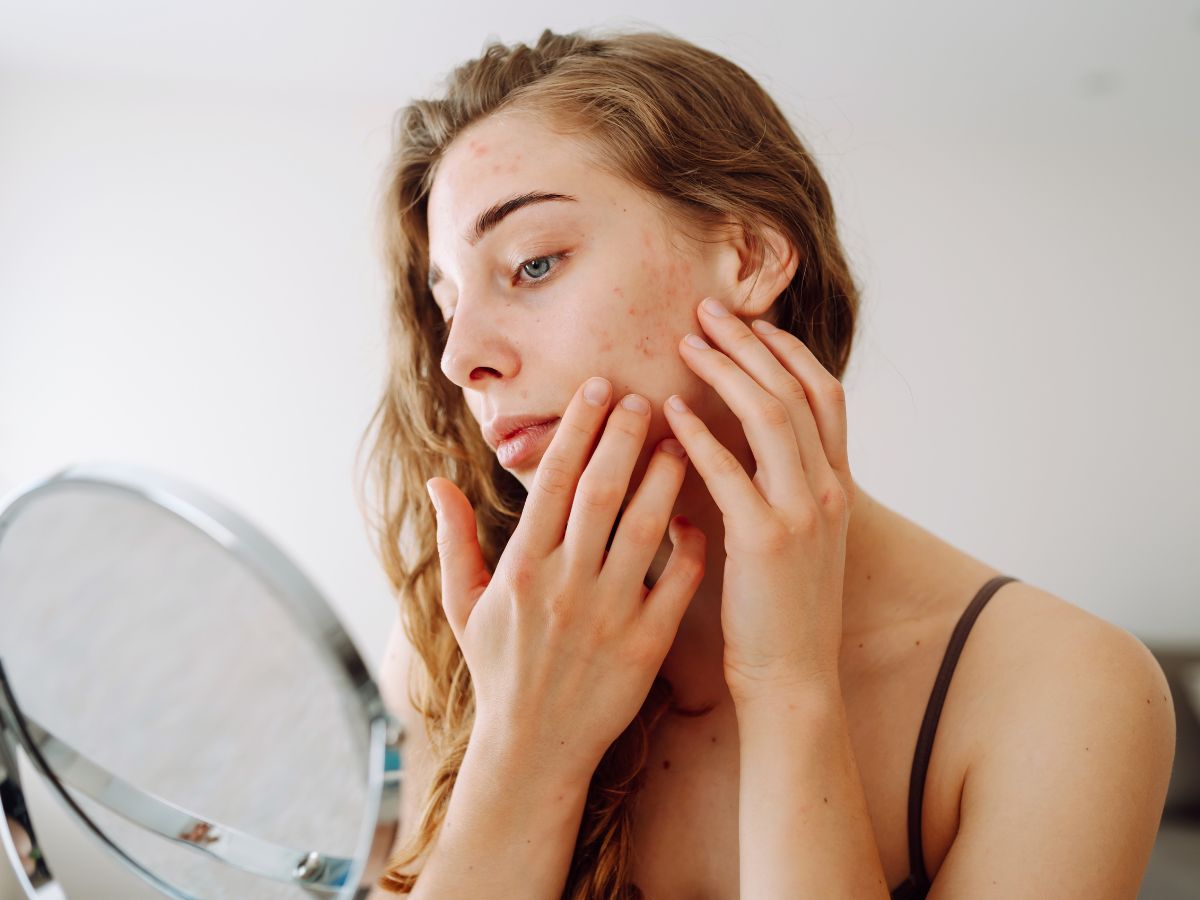 skin dryness - Photo Gallery