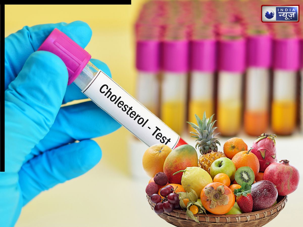 Cholesterol से चॉक हो गई हैं धमियां? कोलेस्ट्रॉल घटाने के लिए खाएं ये 5 फल, पूरी तरह खुल जाएंगी नसें