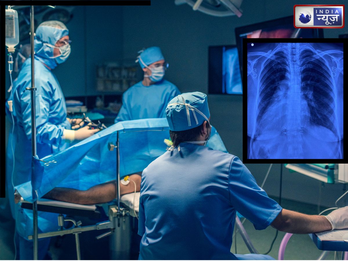 भगवान साक्षात जमीं पर आए… न दिल अपनी जगह था न लिवर, फिर भी RML के डॉक्टरों ने की हार्ट की सफल सर्जरी