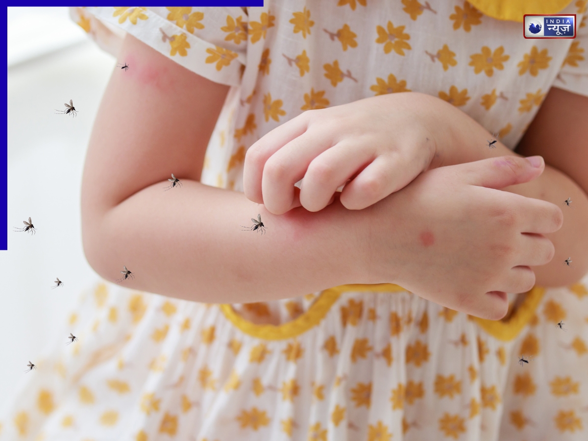 आपको ही क्यों मच्छर ज्यादा काटते हैं? वैज्ञानिकों ने बताई आपकी वो खूबी, जो मच्छरों के लिए है चुंबक, ऐसे बचें!