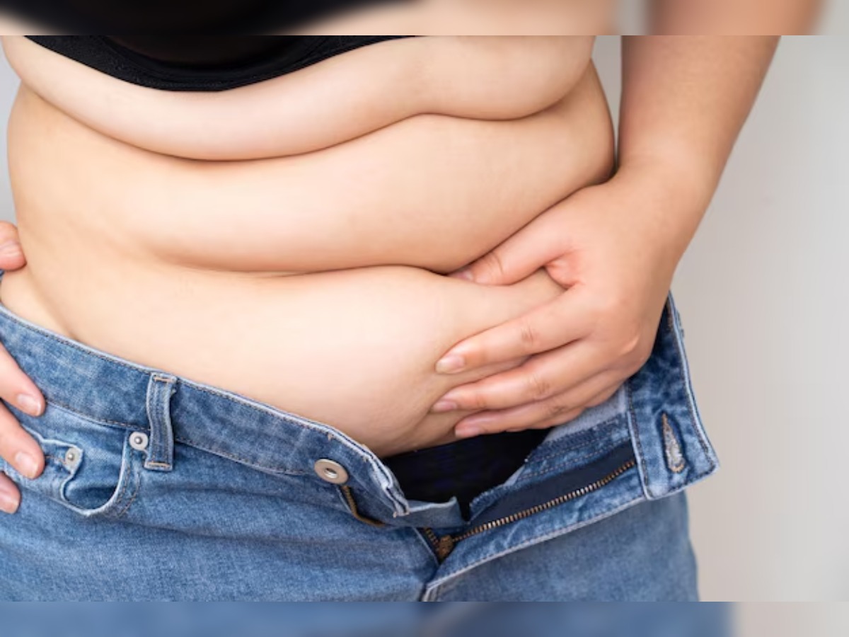 Not making consistent efforts to lose weight - Photo Gallery